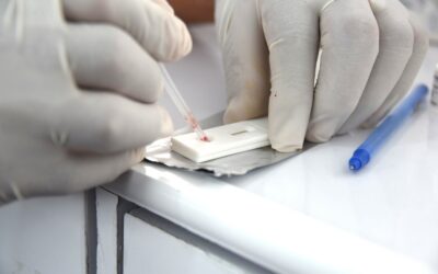 INTENSIFICA SALUD PREVENCIÓN Y CONTROL DE INFECCIONES DE TRANSMISIÓN SEXUAL